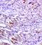 Fibroblast Growth Factor Receptor 1 antibody, orb10655, Biorbyt, Immunohistochemistry paraffin image 