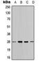 Tyrosine 3-Monooxygenase/Tryptophan 5-Monooxygenase Activation Protein Theta antibody, orb224074, Biorbyt, Western Blot image 