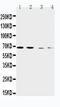 Solute Carrier Family 7 Member 1 antibody, LS-C313519, Lifespan Biosciences, Western Blot image 