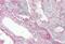 Spectrin Alpha, Non-Erythrocytic 1 antibody, NBP1-53093, Novus Biologicals, Immunohistochemistry paraffin image 