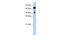 Heat Shock Protein Family A (Hsp70) Member 6 antibody, PA5-44195, Invitrogen Antibodies, Western Blot image 