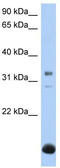 Beta-1,3-Galactosyltransferase 6 antibody, TA342088, Origene, Western Blot image 