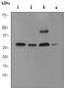 Cathepsin D antibody, ab75852, Abcam, Western Blot image 