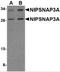 Nipsnap Homolog 3A antibody, 4947, ProSci, Western Blot image 