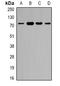 Zinc Finger Protein 195 antibody, orb341281, Biorbyt, Western Blot image 