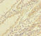 Thioredoxin Like 1 antibody, LS-C317962, Lifespan Biosciences, Immunohistochemistry paraffin image 