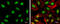 Stromal Antigen 2 antibody, GTX129876, GeneTex, Immunocytochemistry image 