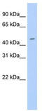 E74 Like ETS Transcription Factor 3 antibody, TA341758, Origene, Western Blot image 