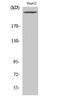 1-phosphatidylinositol-3-phosphate 5-kinase antibody, GTX34124, GeneTex, Western Blot image 