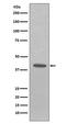 Epithelial Cell Adhesion Molecule antibody, M30950-1, Boster Biological Technology, Western Blot image 