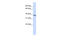 Ectodysplasin A antibody, 25-972, ProSci, Enzyme Linked Immunosorbent Assay image 