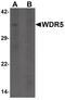 WD Repeat Domain 5 antibody, PA5-34379, Invitrogen Antibodies, Western Blot image 