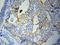 C-Reactive Protein antibody, orb129574, Biorbyt, Immunohistochemistry paraffin image 