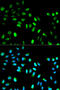 Mitotic Arrest Deficient 1 Like 1 antibody, A01137, Boster Biological Technology, Western Blot image 