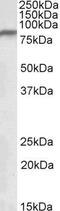 NADH:Ubiquinone Oxidoreductase Core Subunit S1 antibody, GTX88087, GeneTex, Western Blot image 