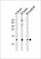 Hemoglobin Subunit Gamma 2 antibody, 61-039, ProSci, Western Blot image 