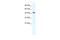 Minichromosome Maintenance Complex Component 7 antibody, 28-544, ProSci, Western Blot image 