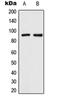 Transient Receptor Potential Cation Channel Subfamily V Member 3 antibody, orb215390, Biorbyt, Western Blot image 