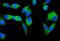 Staphylococcal Nuclease And Tudor Domain Containing 1 antibody, M02602-1, Boster Biological Technology, Immunofluorescence image 