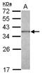 Capping Actin Protein Of Muscle Z-Line Subunit Alpha 1 antibody, NBP2-15692, Novus Biologicals, Western Blot image 