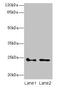 Ras Homolog Family Member F, Filopodia Associated antibody, CSB-PA867192LA01HU, Cusabio, Western Blot image 