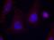 Protein Tyrosine Kinase 2 Beta antibody, GTX50713, GeneTex, Immunocytochemistry image 