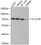 Solute Carrier Family 22 Member 8 antibody, A04087, Boster Biological Technology, Western Blot image 