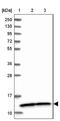 NADH:Ubiquinone Oxidoreductase Subunit A5 antibody, NBP1-88933, Novus Biologicals, Western Blot image 