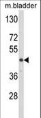 Lumican antibody, LS-C100251, Lifespan Biosciences, Western Blot image 