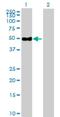 Ectonucleotide Pyrophosphatase/Phosphodiesterase 6 antibody, H00133121-B01P, Novus Biologicals, Western Blot image 