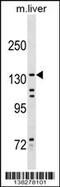 Kinesin Family Member 15 antibody, 59-768, ProSci, Western Blot image 