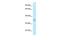 Acyl-CoA Thioesterase 8 antibody, GTX16544, GeneTex, Western Blot image 