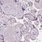 Serine And Arginine Rich Splicing Factor 5 antibody, PA5-55237, Invitrogen Antibodies, Immunohistochemistry paraffin image 