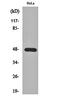 NFKB Inhibitor Alpha antibody, orb161507, Biorbyt, Western Blot image 