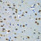 Paired Box 7 antibody, LS-C747822, Lifespan Biosciences, Immunohistochemistry paraffin image 