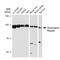 Nuclear Receptor Subfamily 3 Group C Member 1 antibody, GTX09130, GeneTex, Western Blot image 