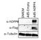 Dipeptidyl Peptidase 4 antibody, M00597-2, Boster Biological Technology, Western Blot image 