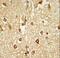 Distal-Less Homeobox 2 antibody, LS-C167445, Lifespan Biosciences, Immunohistochemistry paraffin image 