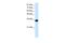 Homeobox D4 antibody, A09189, Boster Biological Technology, Western Blot image 