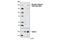 TSC Complex Subunit 2 antibody, 5584T, Cell Signaling Technology, Western Blot image 