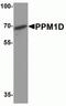 Protein Phosphatase, Mg2+/Mn2+ Dependent 1D antibody, NBP2-81881, Novus Biologicals, Western Blot image 