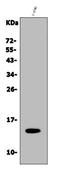 Galectin 2 antibody, A04114-2, Boster Biological Technology, Western Blot image 