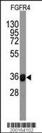 Fibroblast Growth Factor Receptor 4 antibody, TA302089, Origene, Western Blot image 