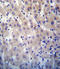 Hypoxanthine Phosphoribosyltransferase 1 antibody, LS-C165004, Lifespan Biosciences, Immunohistochemistry paraffin image 