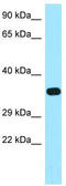 FR-beta antibody, TA338361, Origene, Western Blot image 