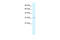 Claudin 10 antibody, 27-902, ProSci, Enzyme Linked Immunosorbent Assay image 