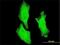 Component Of Inhibitor Of Nuclear Factor Kappa B Kinase Complex antibody, H00001147-M01, Novus Biologicals, Immunofluorescence image 