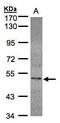 Selenophosphate Synthetase 2 antibody, GTX107917, GeneTex, Western Blot image 