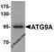Autophagy Related 9A antibody, 6013, ProSci, Western Blot image 