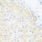 Bromodomain Containing 9 antibody, A08420, Boster Biological Technology, Immunohistochemistry paraffin image 